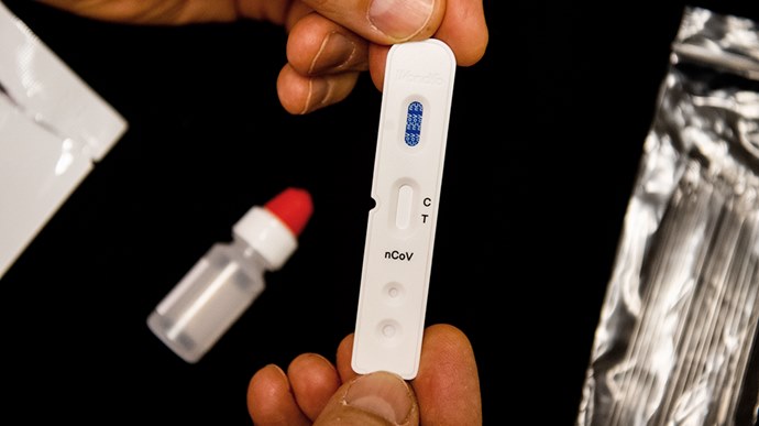 Se houver confirmação da doença, a Secretaria de Saúde estabelecerá data para um novo teste de confirmação do diagnóstico.