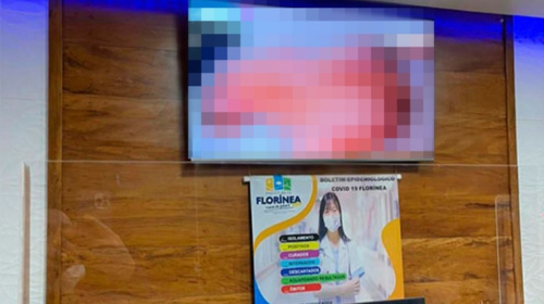 Imagens divulgadas na redes sociais mostram TV da unidade municipal de saúde em Florínea (SP) — Foto: Reprodução/ Redes Sociais