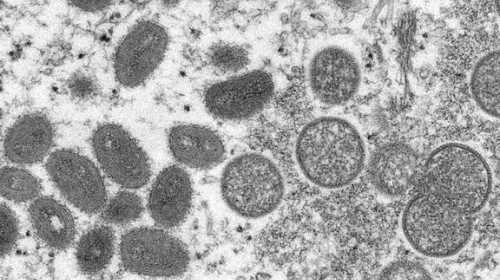 Imagem de microscópio mostra vírus causador da varíola do macaco — Foto: Cynthia S. Goldsmith, Russell Regner/CDC via AP
