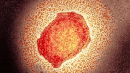 Partícula do vírus da varíola dos macacos; OMS detectou cerca de 80 casos em 12 países — Foto: SCIENCE PHOTO LIBRARY