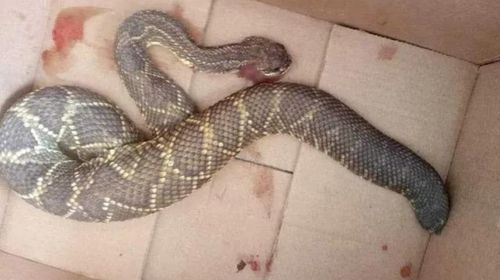 Mulher de 37 ficou ferida após ser mordida por cobra cascavel, em Regente Feijó (SP) — Foto: Redes sociais