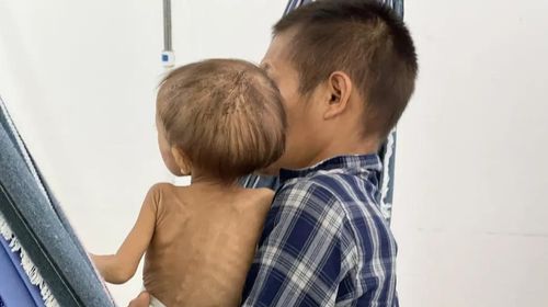 Criança com costelas aparentes no colo do pai Yanomami em hospital de Boa Vista — Foto: Caíque Rodrigues/g1 RR